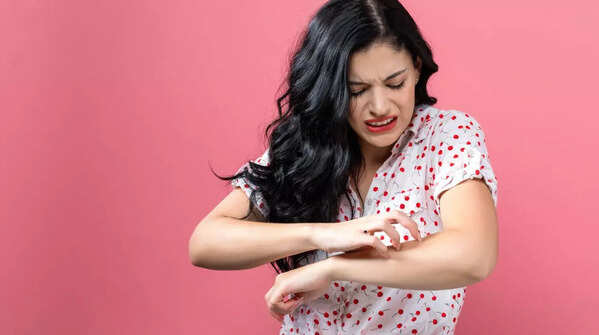 Itchy or bleeding moles can indicate potential issues.