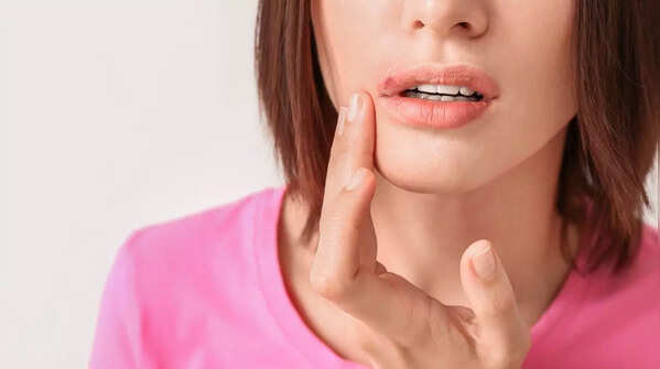A sore that won't heal can be a sign of skin cancer.