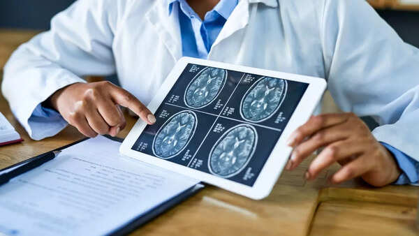 Abstract representation of the brain's complexity